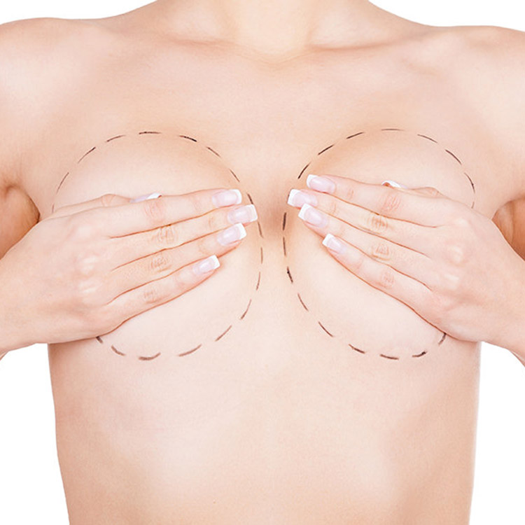 Breast Enlargement Antalya